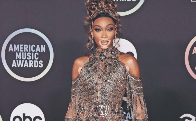 La modelo Winnie Harlow es homenajeada por la ONU