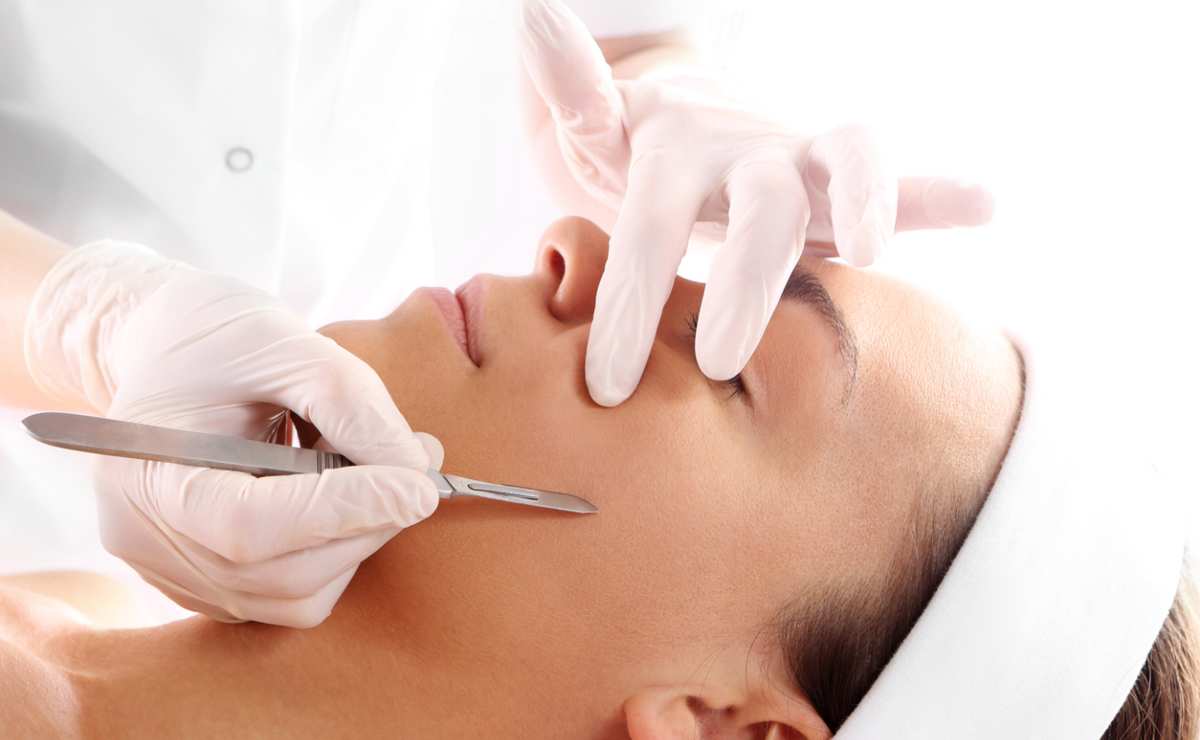 dermaplaning